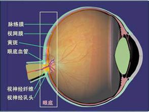什么是视网膜动脉硬化？